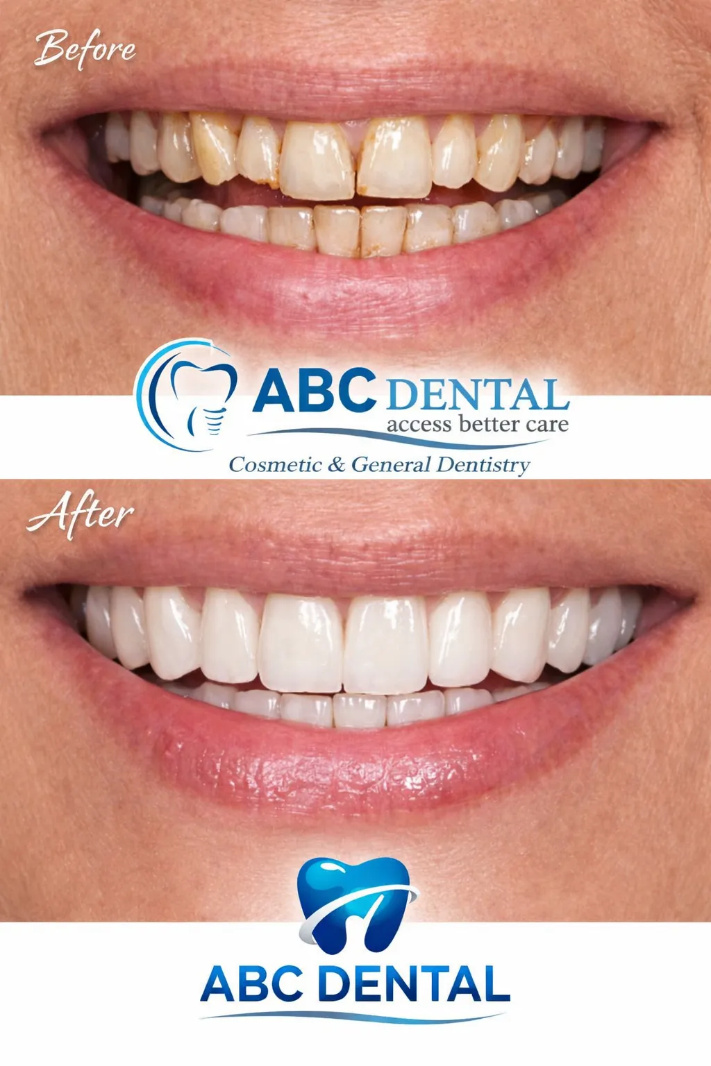Before and after cosmetic dental transformation at ABC Dental Group