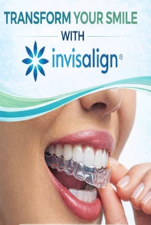 After Invisalign - Crowded Teeth